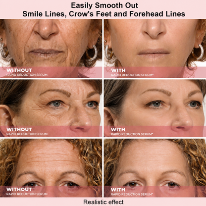 Firming Under-Eye Serum for Fine Lines, Puffiness & Dark Circles