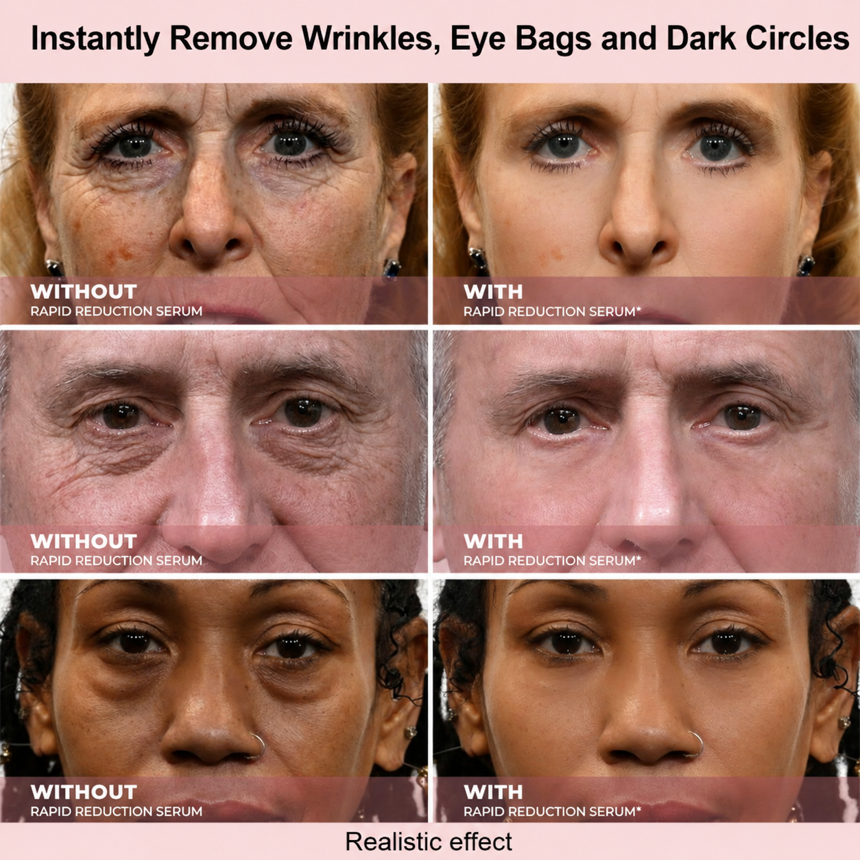 Firming Under-Eye Serum for Fine Lines, Puffiness & Dark Circles