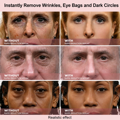 Firming Under-Eye Serum for Fine Lines, Puffiness & Dark Circles
