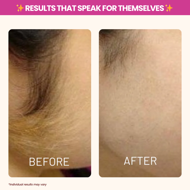 Cyperus Rotundus Oil for Natural Hair Reduction