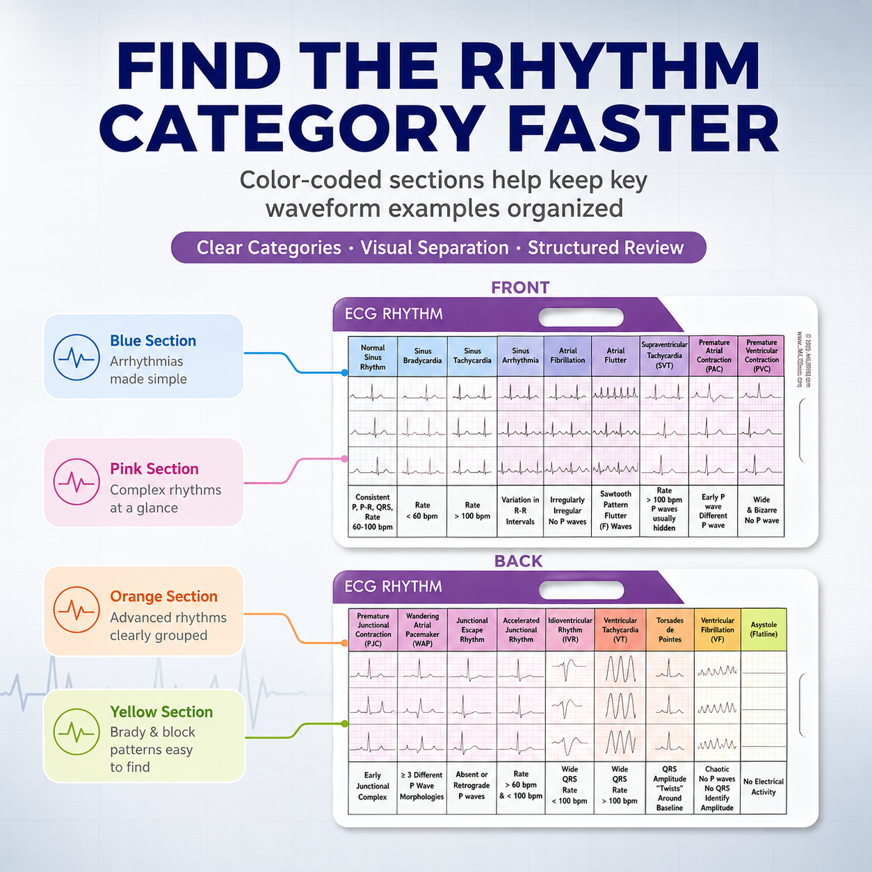 EKG Rhythm Interpretation Card