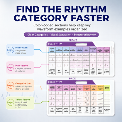 EKG Rhythm Interpretation Card
