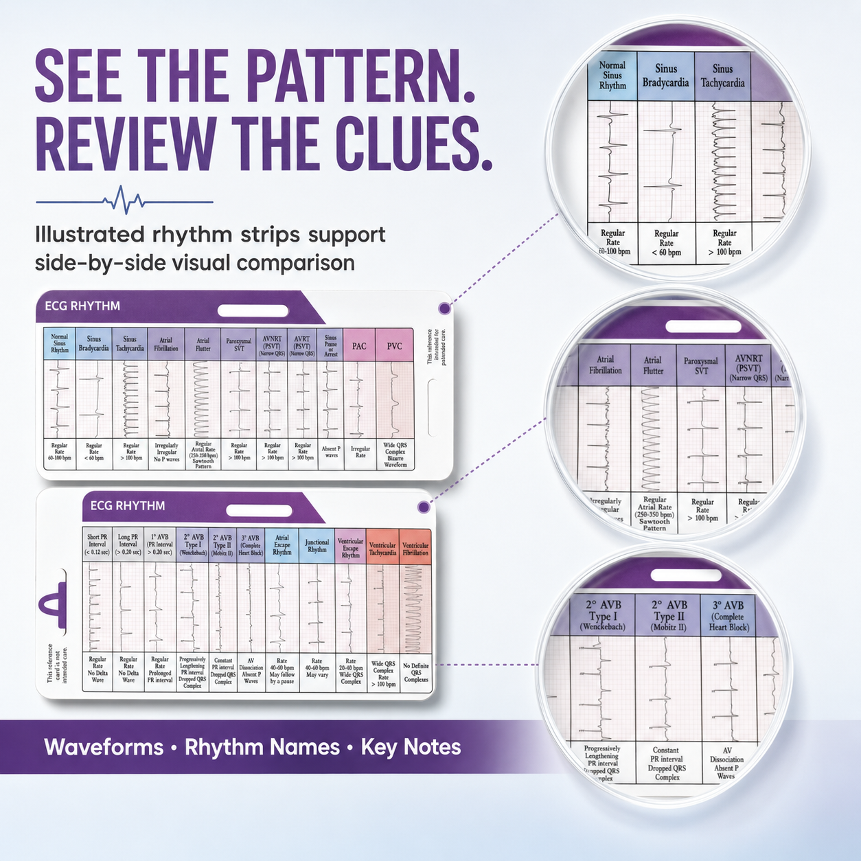 EKG Rhythm Interpretation Card