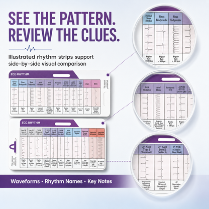 EKG Rhythm Interpretation Card