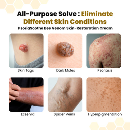 SkinSoothe Bee Venom Skin Comfort Cream