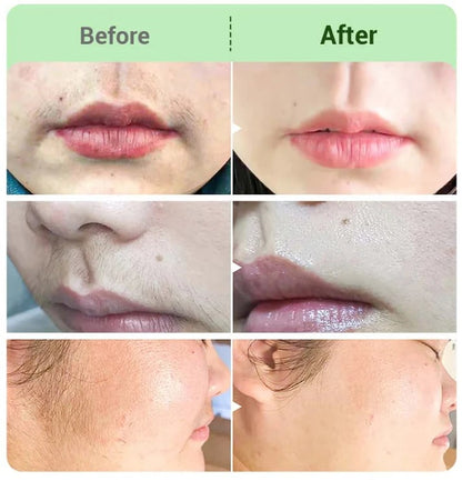 Hair Removal Cream for Women & Men – Gentle Depilatory Cream for Smooth-Looking Skin