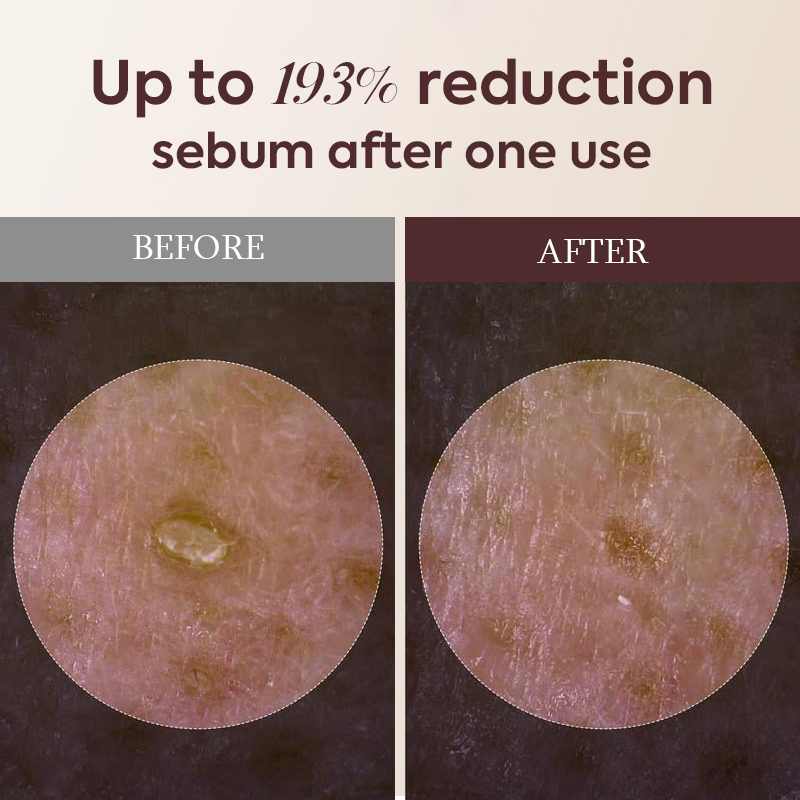 Complete Skin Transformation Set