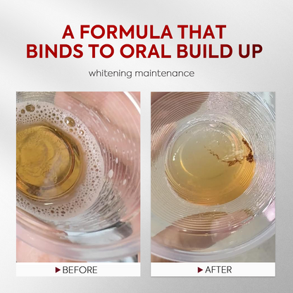 Stain-Lifting Whitening Mouthwash for Debris Removal & Fresh Breath