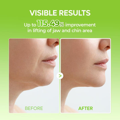 V-Lift Neck Mask