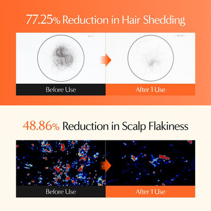 Hair Growth Serum with Built-In Brush