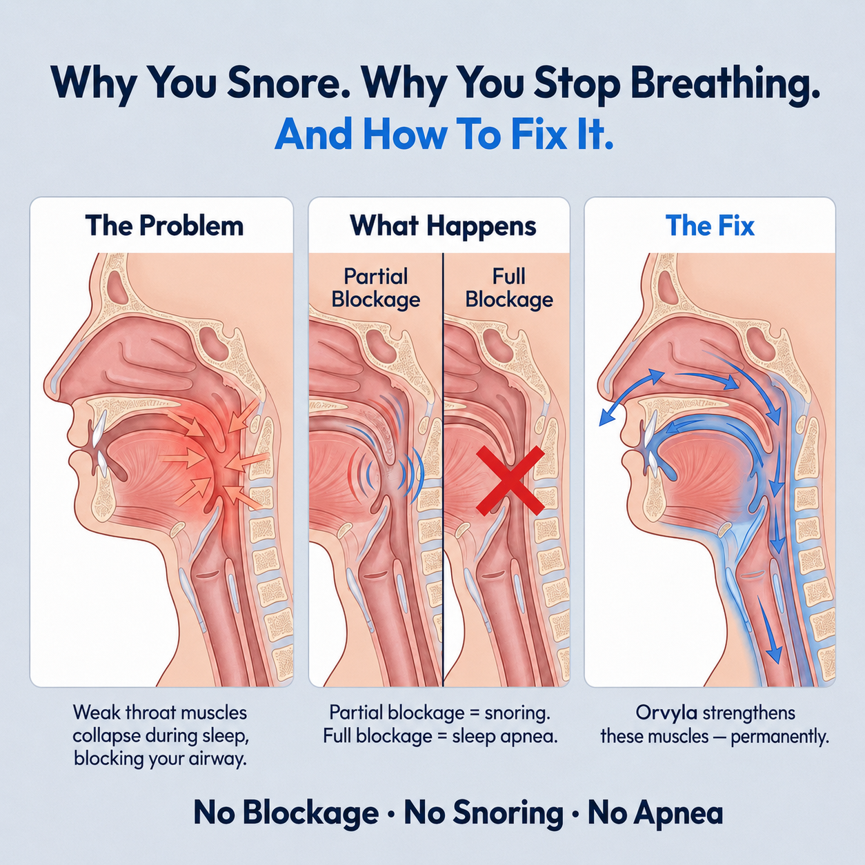 Stop Night Snoring & Improve Sleep Breathing