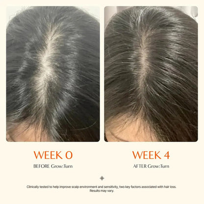 Hair Growth Serum with Built-In Brush