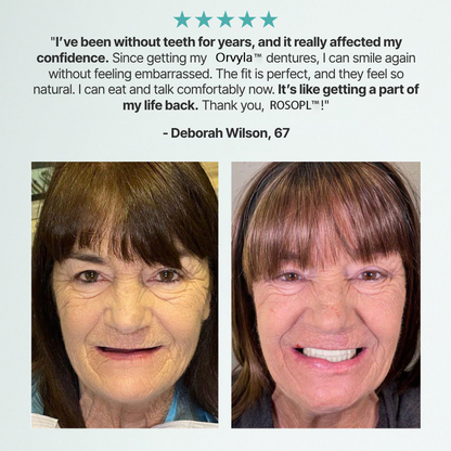 ORVYLA DENTURES-Boil-and-Bite Functional Denture, Self-fit at Home, Fully Adjustable for Narrow or Wide Arches, Long or Short-term Solution, Eat, Drink and Smile Confidently
