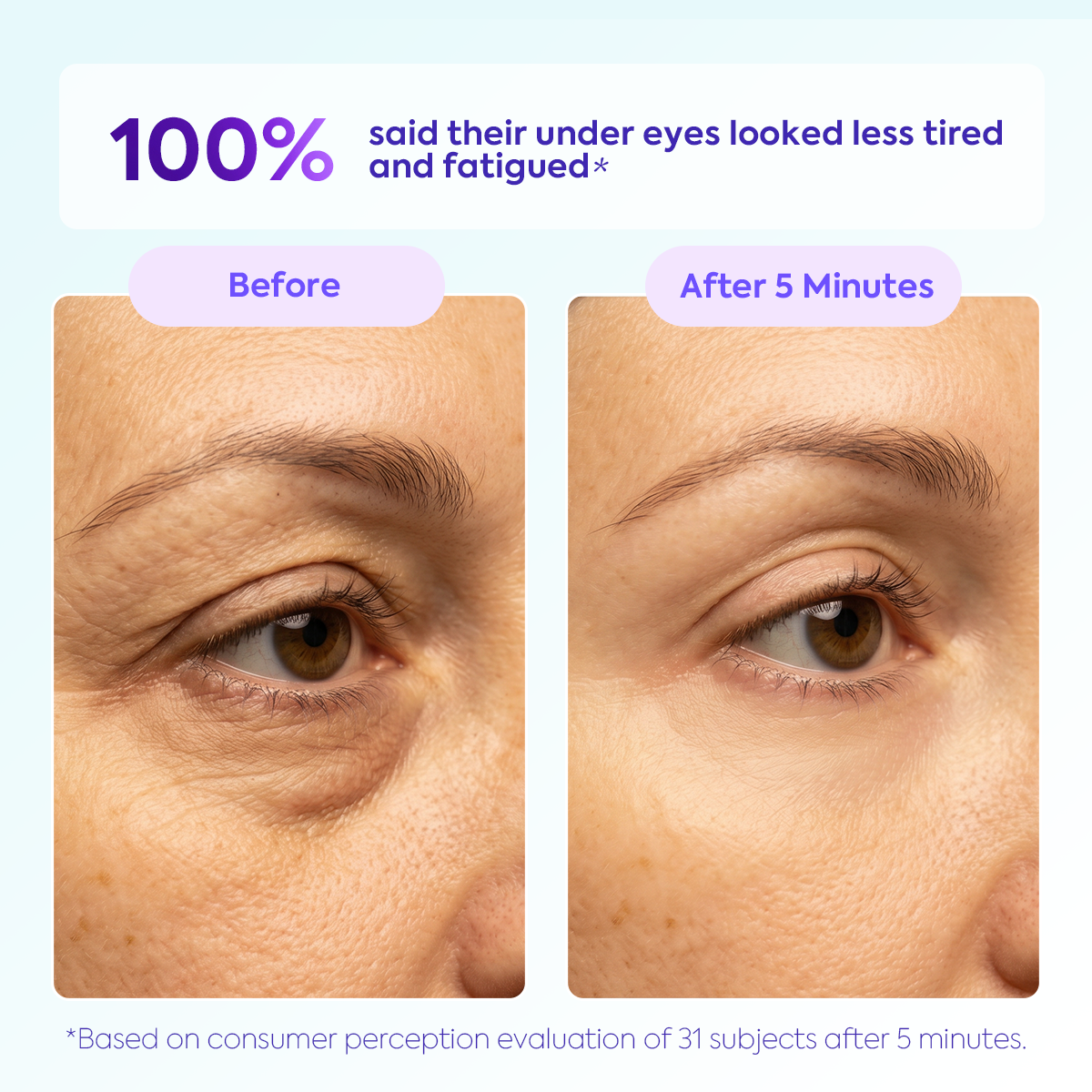 Long-lasting Lifting Eye Serum, Smooths Puffy Under-Eye Area