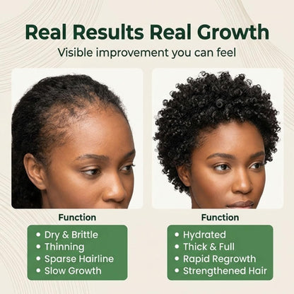 Batana Natural Hair Growth Oil,100% Pure Organic Batana,Prevents Loss for Men & Women