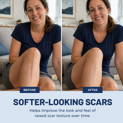 SCAR REMOVAL GEL - Flatter, Smoother, Calmer Scars in as Little as 3 Days