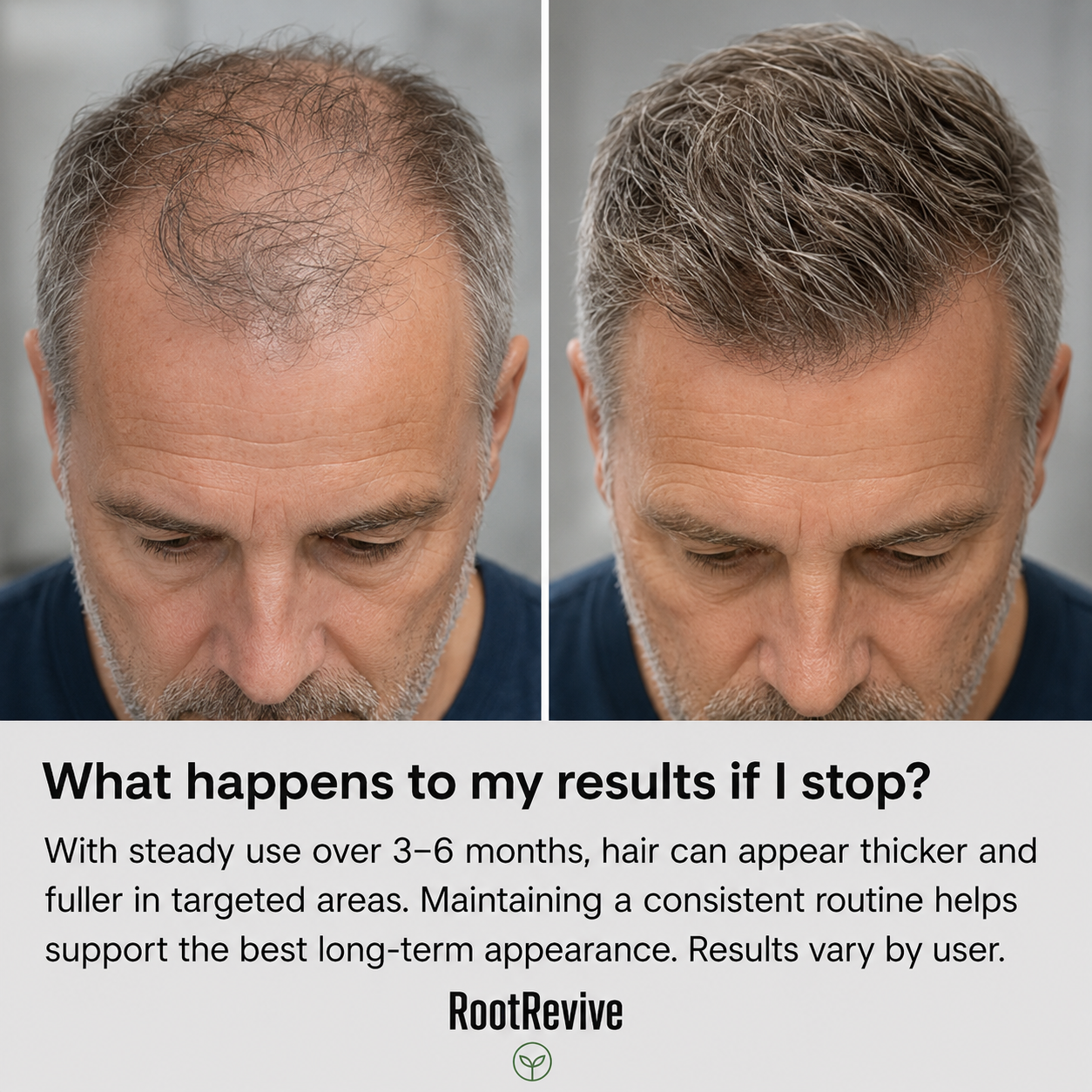 Hair Growth Support System – Scalp Care Kit for Thicker, Fuller-Looking Hair