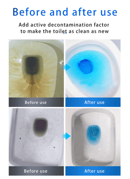 🔥Sink and Drain Cleaner