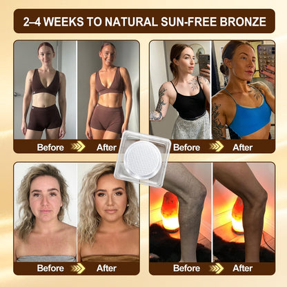 ☀️☀️ 𝐒𝐮𝐧-𝐅𝐫𝐞𝐞 𝐓𝐚𝐧𝐧𝐢𝐧𝐠 𝐌𝐢𝐜𝐫𝐨-𝐍𝐞𝐞𝐝𝐥𝐞 𝐏𝐚𝐭𝐜𝐡