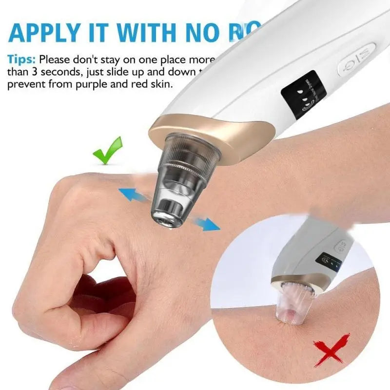 Rechargeable Electric Blackhead Remover, 3-Level Suction, Facial Care Tool