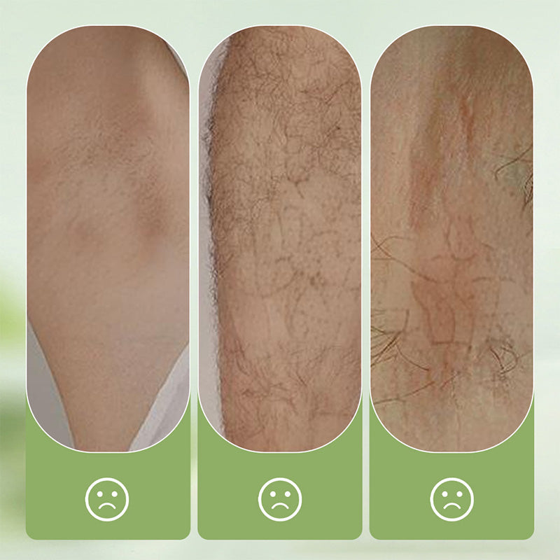🧴 Large-capacity Gentle Hair Removal Cream