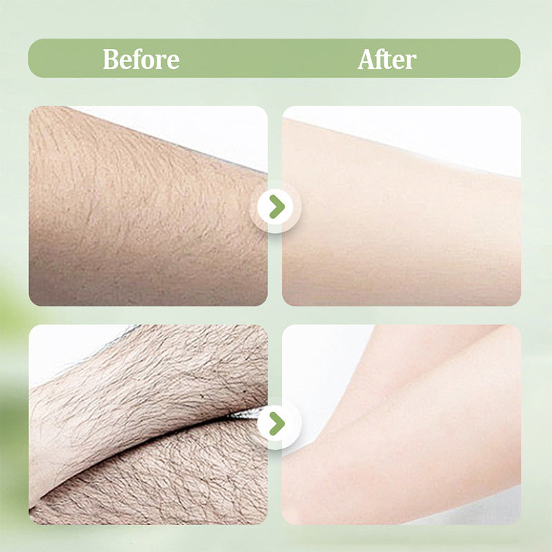 🧴 Large-capacity Gentle Hair Removal Cream