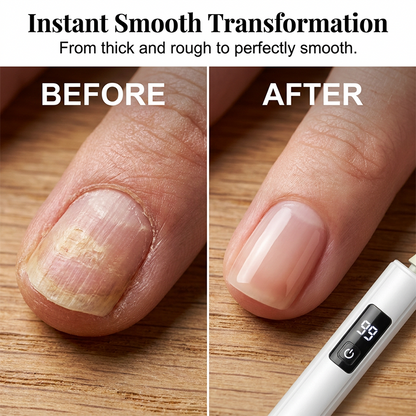 💅✨Professional Electric Nail Polisher –99-speed Multiple heads for shaping & buffing🌟💎
